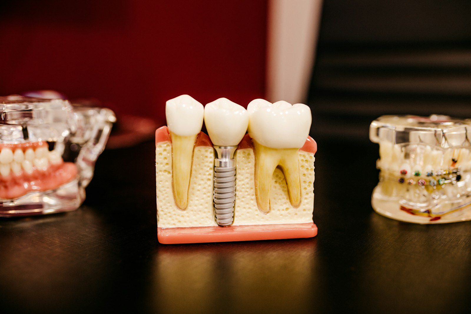Dental Tourism
